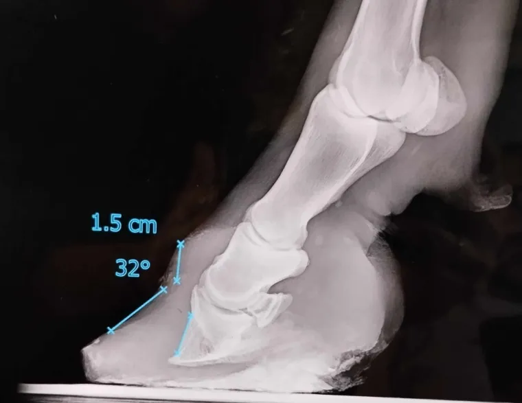 Radiographie de pied de poney fourbu présentant une bascule de la troisième phalange 