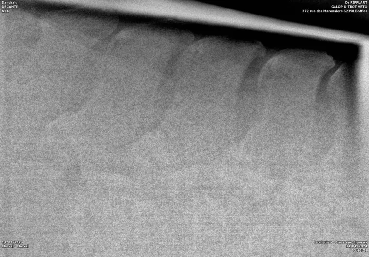 Radiographie de conflit de processus épineux